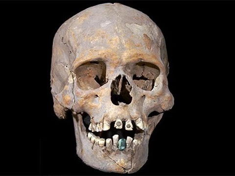 В Мексике археологи нашли скелет с каменным протезом зуба
