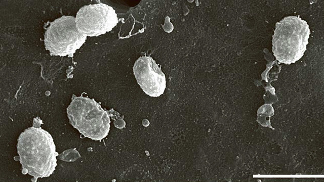 Ученые узнали, как кишечные микробы влияют на лечение рака простаты