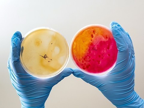 Антибиотики могут провоцировать рост колоний бактерий