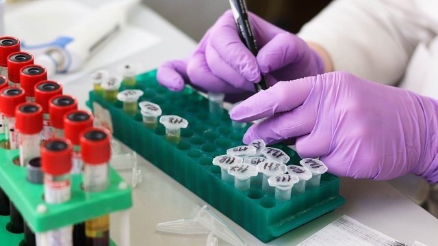 Исследование антител указало на возможность разработки вакцины против всех коронавирусов