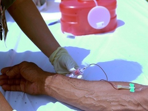 Число случаев заражения ВИЧ в Москве выросло на 11%