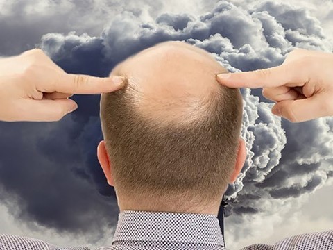 Загрязнение воздуха может оказаться причиной облысения