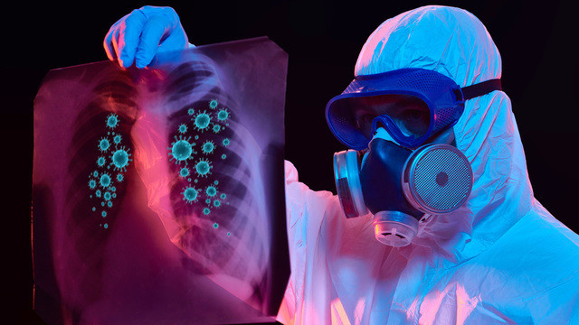 Как отличить ковидную пневмонию от бактериальной?