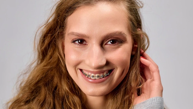 Меняется ли лицо после брекетов? Объясняет стоматолог