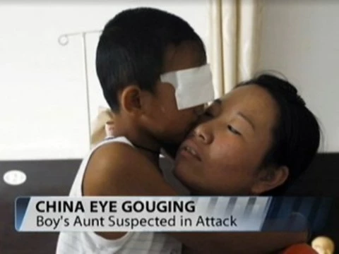 Китайский врач решил [подарить мальчику бионические глаза]