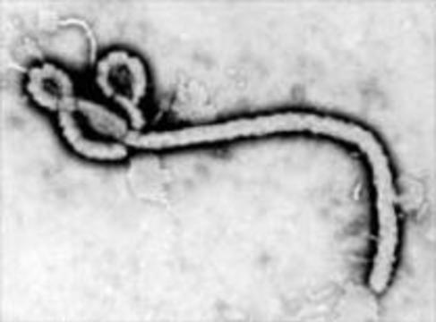 Новый штамм Эболы грозит эпидемией в Судане