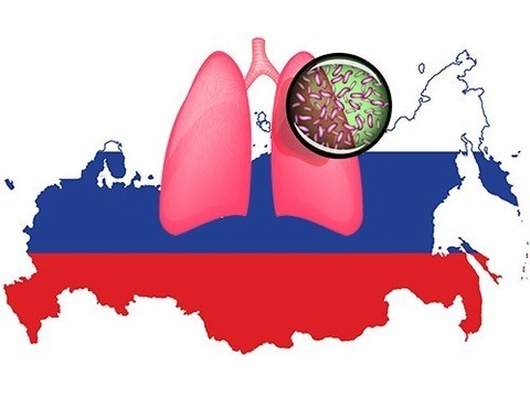 Исследователи предсказали России много устойчивого туберкулеза к 2040 году