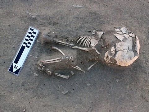 У младенца, жившего более 5500 лет назад, диагностировали цингу