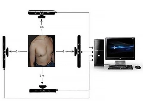 Xbox Kinect поможет выявить проблемы с легкими