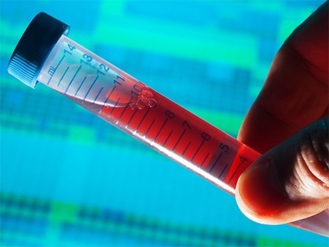 Новый биомаркер покажет, окажется ли лечение колоректального рака эффективным