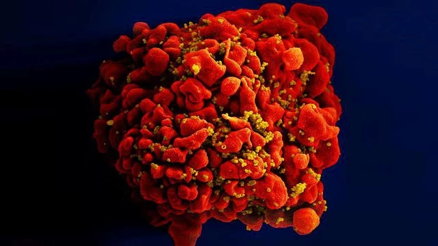 Полный геном ВИЧ найден в образце человеческой ткани, взятой в 1966 году в Конго