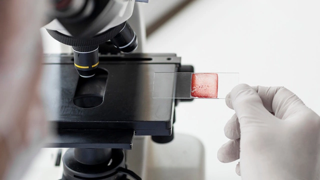 “Я боюсь рака...” Надо ли сдавать онкомаркеры для профилактики?