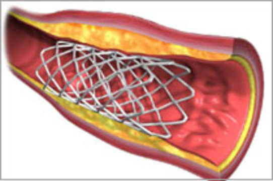 Сосуды сердца будут расширять [растворимыми стентами]
