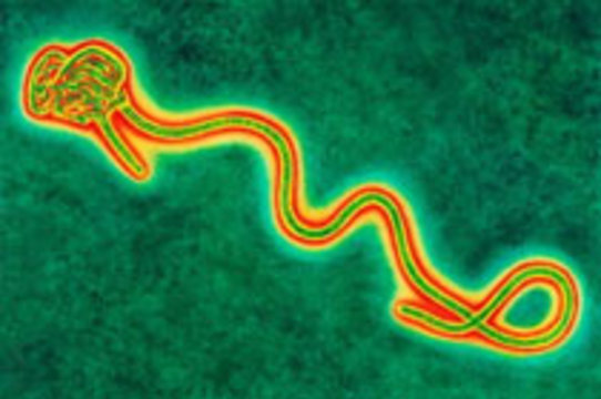 Ученые обезопасили [вирус лихорадки Эбола]