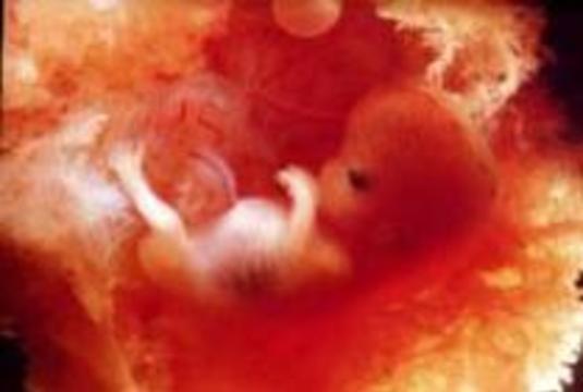 Европейский суд не смог запретить аборты