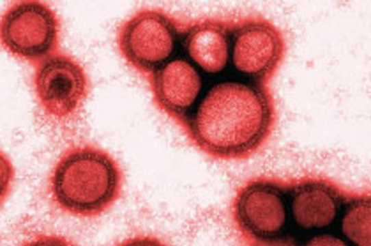 Ученые вычислили [показатель смертности для гриппа H1N1]