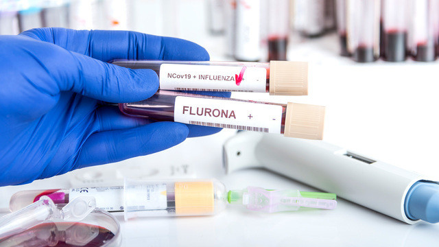«Коронагрипп», или «flurona»: ждет ли нас всплеск одновременного заражения гриппом и COVID-19?