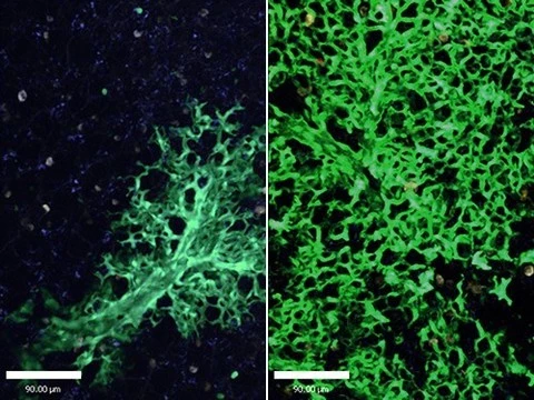 Ученые опробовали стволовые клетки для восстановления легких