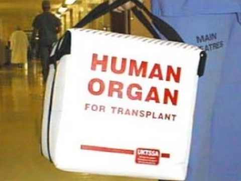 Московским трансплантологам не хватает [донорских органов]