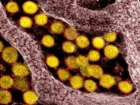 Исследование: Коронавирус может распространяться быстрее, чем считалось