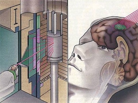 Новый ускоритель уничтожил 99% раковых клеток