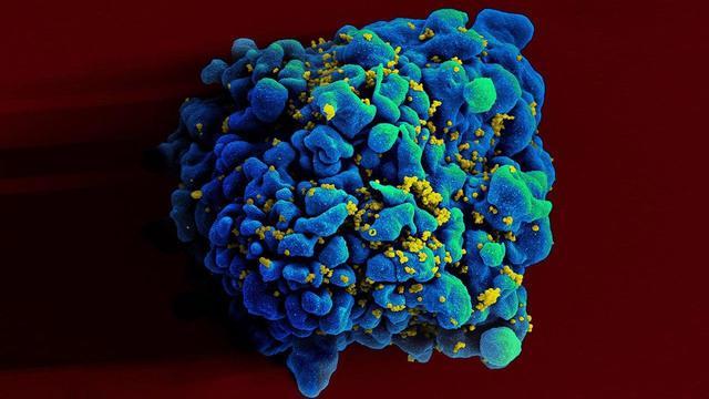 Ученые заявили, что впервые вылечили ВИЧ-инфекцию при помощи лекарств