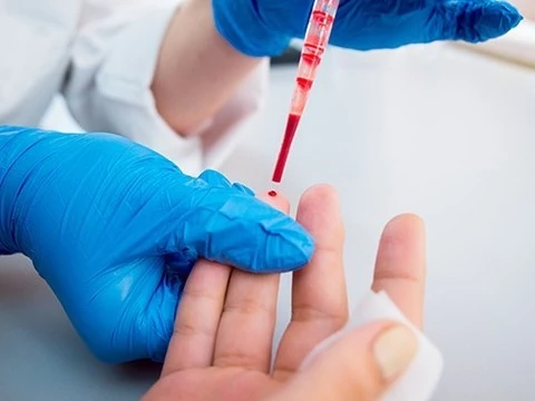 Ежегодный анализ крови поможет вовремя выявить рак яичников