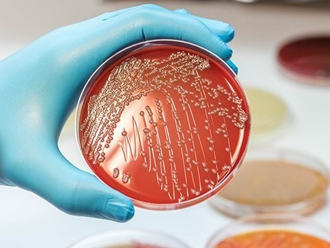 Новый тест выявит устойчивые к антибиотикам бактерии