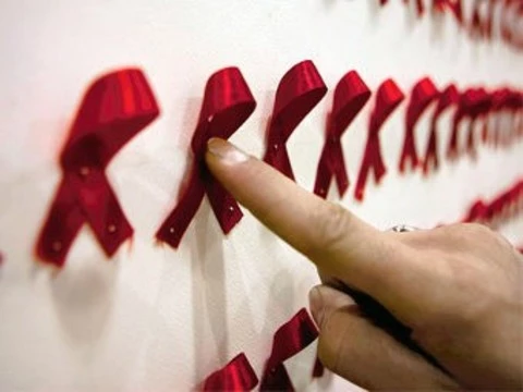 Заболеваемость ВИЧ-инфекцией в России [снизилась]