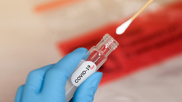 Стало известно, как меняется риск ложноотрицательных тестов на COVID-19 с течением времени