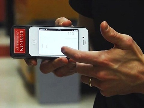 Бионическая поджелудочная железа успешно контролирует уровень сахара в крови пациентов