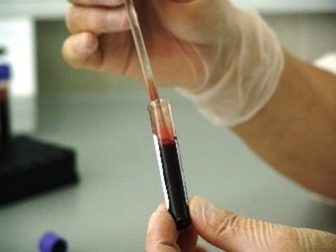 В январе в России выявили [почти пять тысяч ВИЧ-инфицированных]