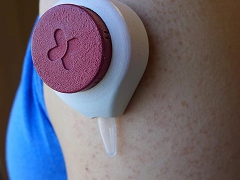 Разработан портативный прибор для безболезненных анализов крови