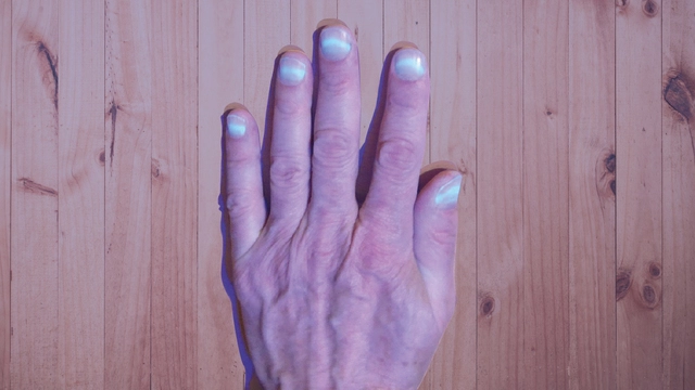 «Светятся ногти»: переболевшие COVID-19 столкнулись с необычным явлением