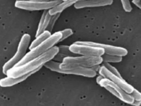 Американские ученые предложили лечить туберкулез [препаратами от болезни Паркинсона]