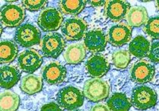 Вирус герпеса фото человека под микроскопом