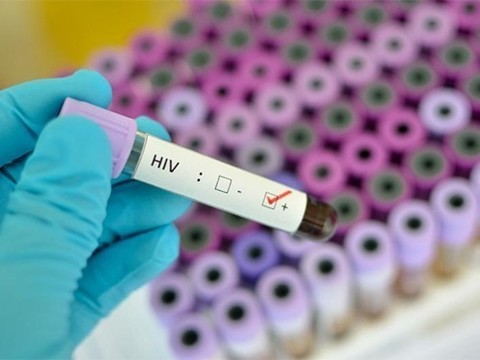 Врачам впервые в мире удалось вылечить пациента с ВИЧ