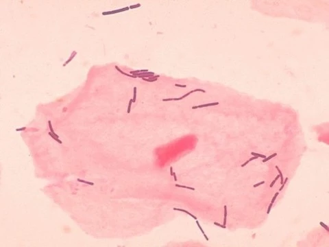 Ученые составили крупнейший каталог вагинальной микробиоты