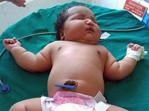 В Индии родилась девочка весом 6,8 кг