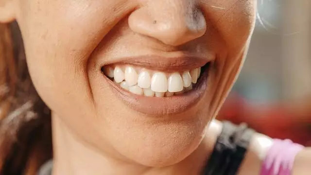 Отбеливание может повредить зубы