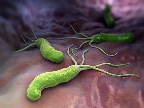 Рак, гастрит и аллергия: последствия соседства с Helicobacter pylori
