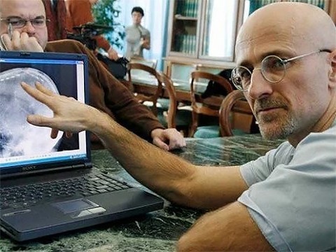 Стали известны новые подробности об операции по пересадке головы