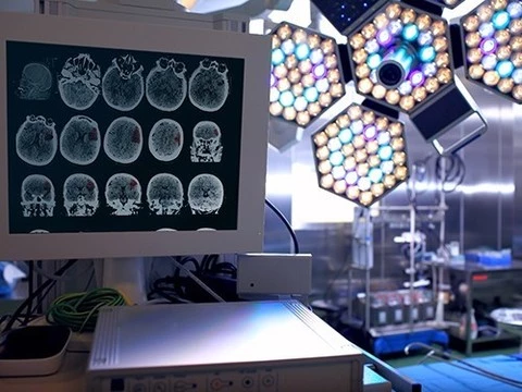 Сканирование головного мозга определяет, когда пациент выйдет из комы