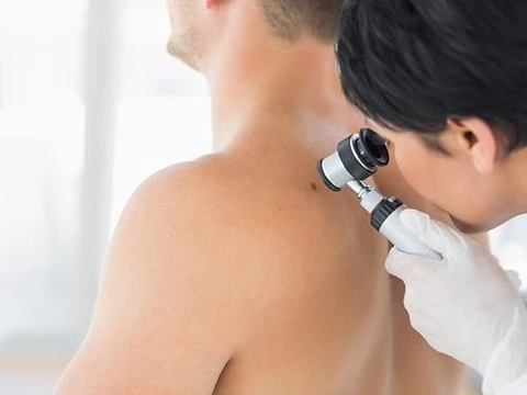Здоровую кожу можно использовать для диагностики рака