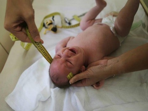 Вирус Зика может вызвать глухоту