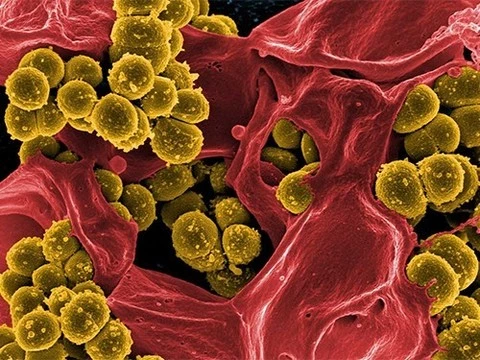 Ученые нашли возможность разрушить бактерии стафилококка, «засолив» их