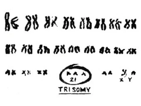 Виновную в синдроме Дауна хромосому [впервые выключили]