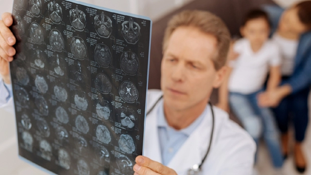 Исследование описало частоту случайных находок при МРТ мозга у детей