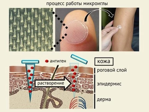 Вакцина от гриппа в форме пластыря заменит инъекции