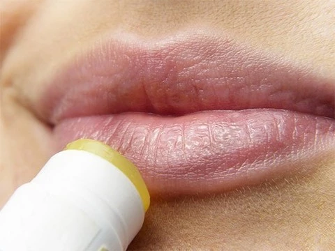 Простуда на губах: почему появляется и как лечить? - полезные статьи